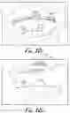 Fig. 09 - Fixation base and guides for dental prosthesis installation