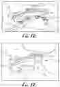 Fig. 12 - Fixation base and guides for dental prosthesis installation