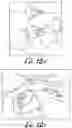Fig. 14 - Fixation base and guides for dental prosthesis installation