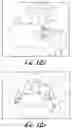 Fig. 16 - Fixation base and guides for dental prosthesis installation