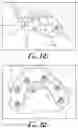 Fig. 17 - Fixation base and guides for dental prosthesis installation