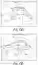 Fig. 18 - Fixation base and guides for dental prosthesis installation