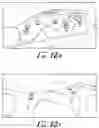 Fig. 19 - Fixation base and guides for dental prosthesis installation