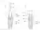 Fig. 08 - Cementless Type Dental Implant