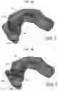 Fig. 16 - Method of generating three dimensional model using virtual bridge based multi input Boolean operation