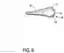 Fig. 07 - BONE GRAFT CARRIER