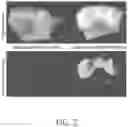 Fig. 03 - FUNCTIONALIZED PROSTHETIC INTERFACES FOR THE PREVENTION AND TREATMENT OF DENTAL CONDITIONS