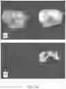 Fig. 11 - FUNCTIONALIZED PROSTHETIC INTERFACES FOR THE PREVENTION AND TREATMENT OF DENTAL CONDITIONS