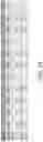 Fig. 13 - FUNCTIONALIZED PROSTHETIC INTERFACES FOR THE PREVENTION AND TREATMENT OF DENTAL CONDITIONS