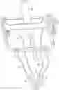 Fig. 01 - Methods and devices for tensioning grafts