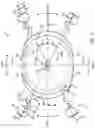 Fig. 04 - Intraocular Refractive Phakic Lens and Method