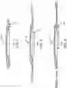 Fig. 06 - Intraocular Refractive Phakic Lens and Method