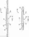 Fig. 09 - Intraocular Refractive Phakic Lens and Method