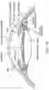 Fig. 12 - Intraocular Refractive Phakic Lens and Method