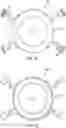 Fig. 13 - Intraocular Refractive Phakic Lens and Method