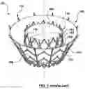 Fig. 02 - Valve delivery system having an integral displacement component for managing chordae tendineae in situ and methods of use thereof