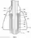 Fig. 08 - Valve delivery system having an integral displacement component for managing chordae tendineae in situ and methods of use thereof