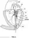 Fig. 10 - Valve delivery system having an integral displacement component for managing chordae tendineae in situ and methods of use thereof