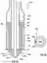 Fig. 21 - Valve delivery system having an integral displacement component for managing chordae tendineae in situ and methods of use thereof