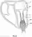 Fig. 23 - Valve delivery system having an integral displacement component for managing chordae tendineae in situ and methods of use thereof