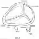 Fig. 02 - TRICUSPID VALVE REPAIR DEVICES AND ASSOCIATED SYSTEMS AND METHODS