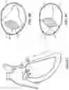 Fig. 10 - TRICUSPID VALVE REPAIR DEVICES AND ASSOCIATED SYSTEMS AND METHODS