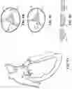 Fig. 11 - TRICUSPID VALVE REPAIR DEVICES AND ASSOCIATED SYSTEMS AND METHODS