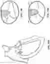 Fig. 13 - TRICUSPID VALVE REPAIR DEVICES AND ASSOCIATED SYSTEMS AND METHODS