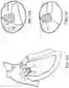 Fig. 14 - TRICUSPID VALVE REPAIR DEVICES AND ASSOCIATED SYSTEMS AND METHODS