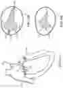 Fig. 16 - TRICUSPID VALVE REPAIR DEVICES AND ASSOCIATED SYSTEMS AND METHODS