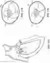 Fig. 22 - TRICUSPID VALVE REPAIR DEVICES AND ASSOCIATED SYSTEMS AND METHODS