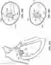 Fig. 23 - TRICUSPID VALVE REPAIR DEVICES AND ASSOCIATED SYSTEMS AND METHODS
