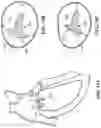 Fig. 24 - TRICUSPID VALVE REPAIR DEVICES AND ASSOCIATED SYSTEMS AND METHODS