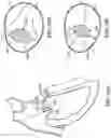 Fig. 25 - TRICUSPID VALVE REPAIR DEVICES AND ASSOCIATED SYSTEMS AND METHODS