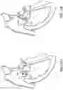 Fig. 29 - TRICUSPID VALVE REPAIR DEVICES AND ASSOCIATED SYSTEMS AND METHODS