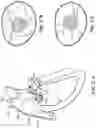 Fig. 32 - TRICUSPID VALVE REPAIR DEVICES AND ASSOCIATED SYSTEMS AND METHODS