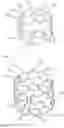 Fig. 04 - CONNECTING STRUCTURE FOR STENT AND VALVE LEAFLETS, AND INTERVENTIONAL PULMONARY VALVE AND INTERVENTIONAL AORTIC VALVE USING SAME