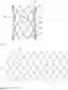 Fig. 06 - CONNECTING STRUCTURE FOR STENT AND VALVE LEAFLETS, AND INTERVENTIONAL PULMONARY VALVE AND INTERVENTIONAL AORTIC VALVE USING SAME
