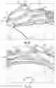 Fig. 06 - PROSTHETIC HEART VALVES