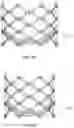Fig. 14 - PROSTHETIC HEART VALVES