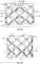 Fig. 18 - PROSTHETIC HEART VALVES