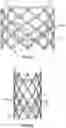 Fig. 23 - PROSTHETIC HEART VALVES
