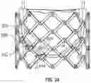 Fig. 29 - PROSTHETIC HEART VALVES