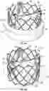 Fig. 03 - TRANSCATHETER HEART VALVE DELIVERY SYSTEMS AND METHODS