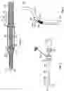 Fig. 05 - TRANSCATHETER HEART VALVE DELIVERY SYSTEMS AND METHODS
