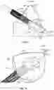 Fig. 10 - TRANSCATHETER HEART VALVE DELIVERY SYSTEMS AND METHODS