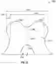 Fig. 13 - TRANSCATHETER HEART VALVE DELIVERY SYSTEMS AND METHODS