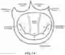 Fig. 02 - CARDIAC VALVE REPAIR DEVICES AND ASSOCIATED SYSTEMS AND METHODS