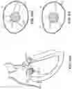 Fig. 101 - CARDIAC VALVE REPAIR DEVICES AND ASSOCIATED SYSTEMS AND METHODS