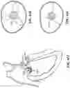 Fig. 105 - CARDIAC VALVE REPAIR DEVICES AND ASSOCIATED SYSTEMS AND METHODS